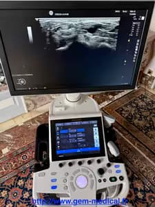 Echographe logiq p9 ge reconditionné