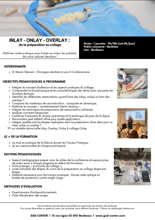 Inlay, Onlay, Overlay