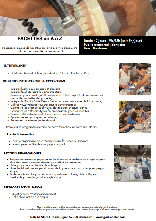 Les Facettes de A à Z
