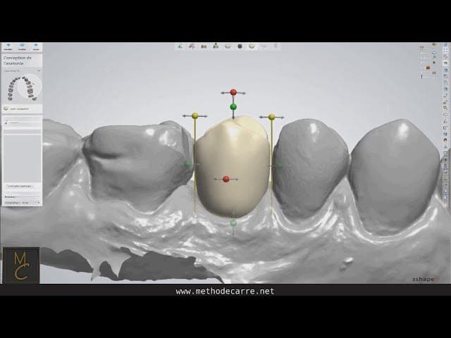 Dentisterie numérique : découverte pratique de la CFAO au cabinet